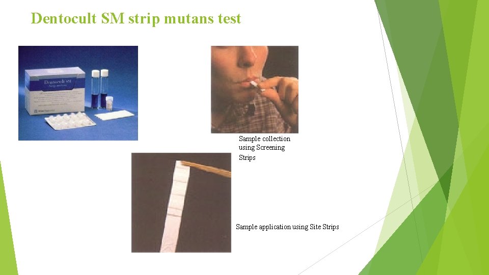 Dentocult SM strip mutans test Sample collection using Screening Strips Sample application using Site