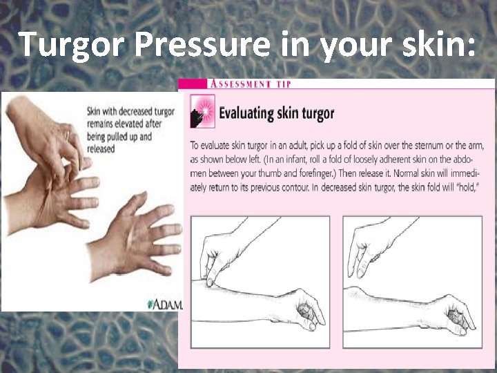 Turgor Pressure in your skin: 