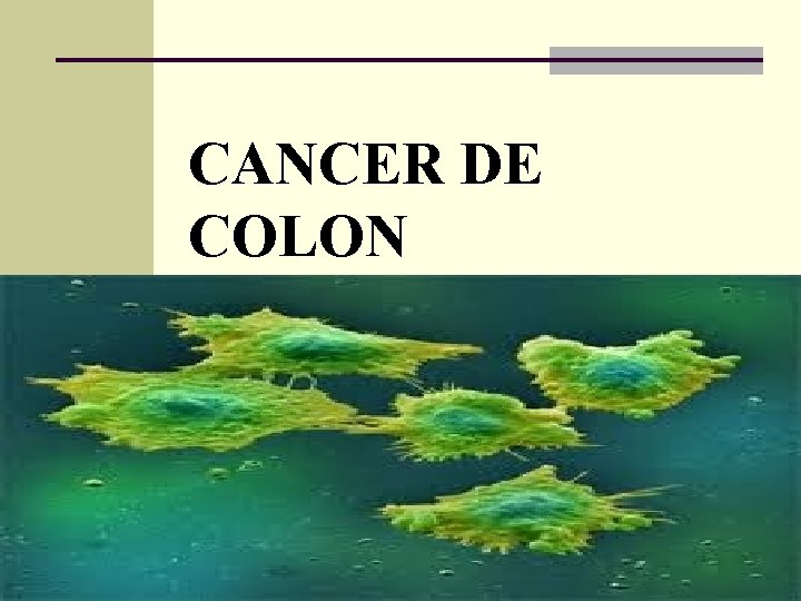 CANCER DE COLON 