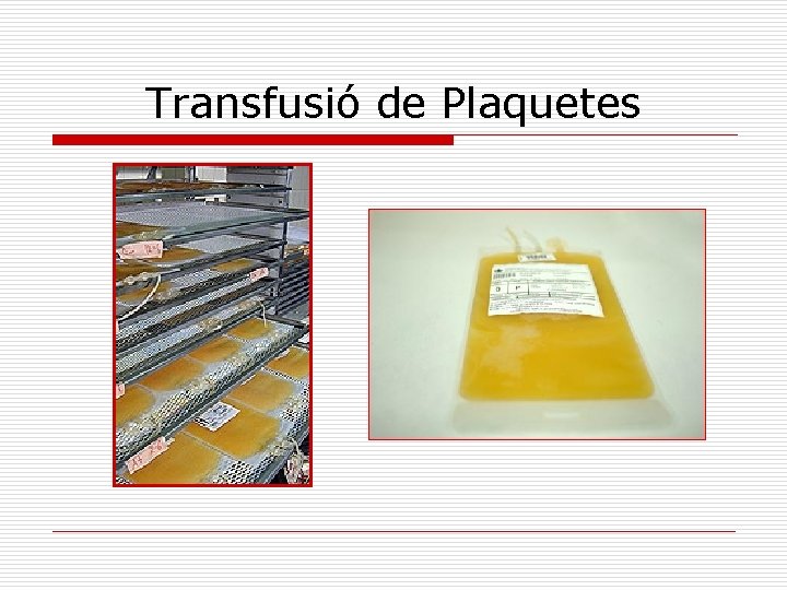 Transfusió de Plaquetes 