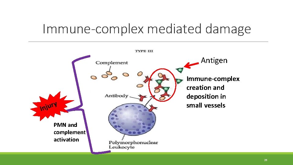Immune-complex mediated damage Antigen y r u j In Immune-complex creation and deposition in Immune-complex mediated damage Antigen y r u j In Immune-complex creation and deposition in