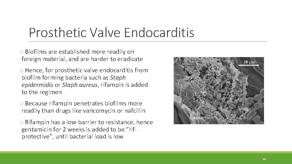 Prosthetic Valve Endocarditis o Biofilms are established more readily on foreign material, and are Prosthetic Valve Endocarditis o Biofilms are established more readily on foreign material, and are