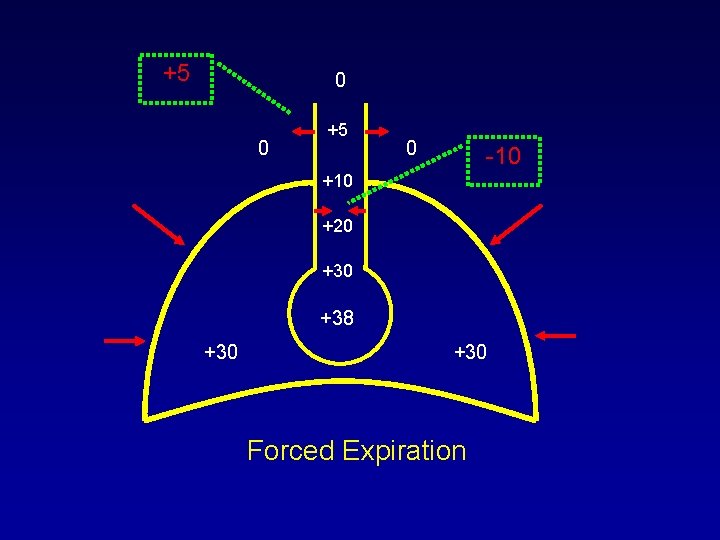 +5 0 0 +5 0 -10 +20 +38 +30 Forced Expiration +5 0 0 +5 0 -10 +20 +38 +30 Forced Expiration