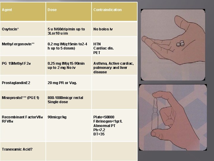 Agent Dose Contraindication Oxytocin* 5 u IV 60 drip/min up to 3 Lor 10