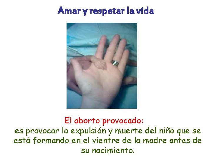 Amar y respetar la vida El aborto provocado: es provocar la expulsión y muerte