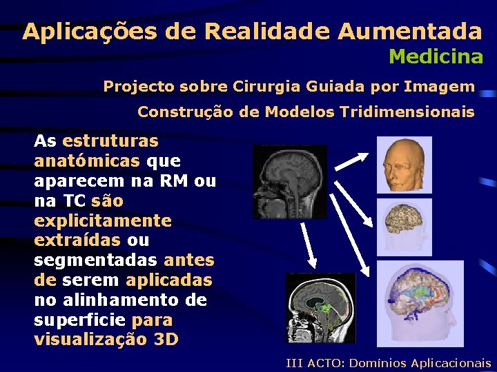 Aplicações de Realidade Aumentada Medicina Projecto sobre Cirurgia Guiada por Imagem Construção de Modelos