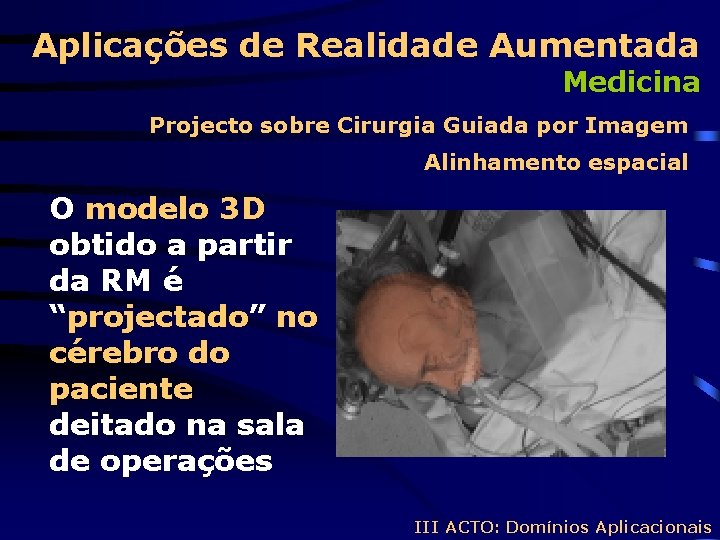 Aplicações de Realidade Aumentada Medicina Projecto sobre Cirurgia Guiada por Imagem Alinhamento espacial O