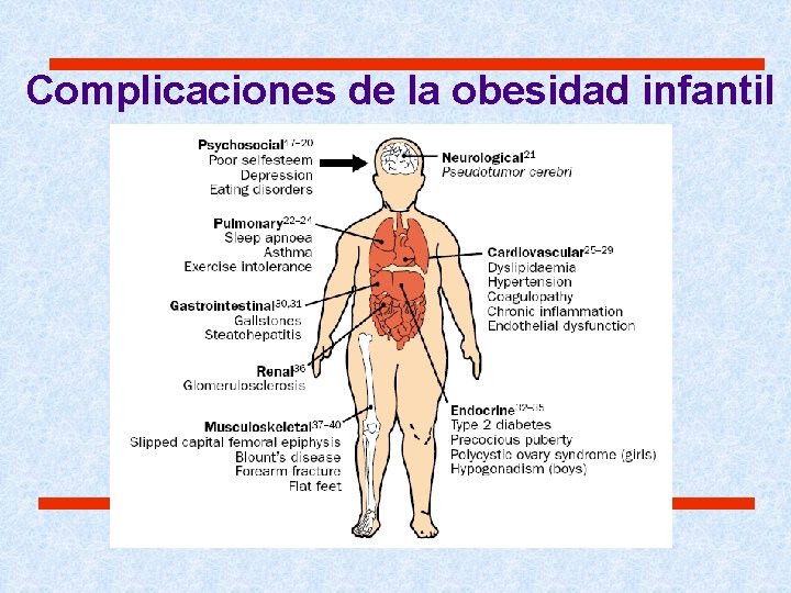 Complicaciones de la obesidad infantil Complicaciones de la obesidad infantil
