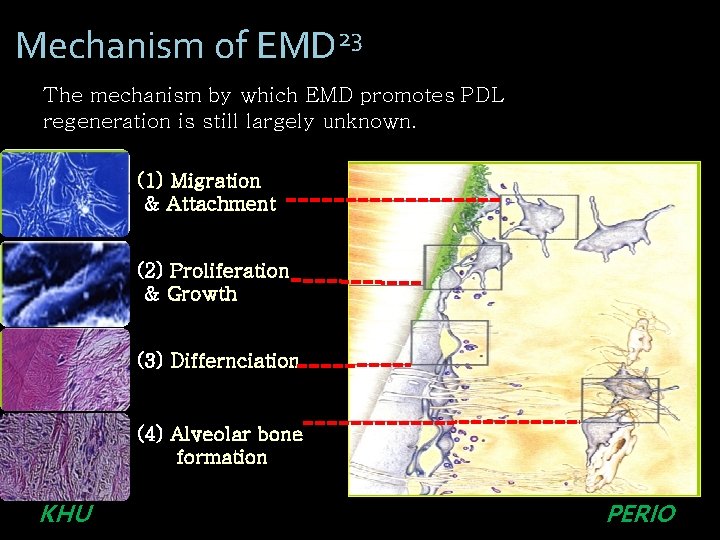 Mechanism of EMD 23 The mechanism by which EMD promotes PDL regeneration is still