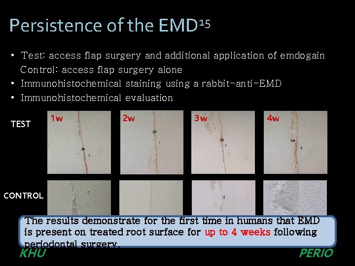Persistence of the EMD 15 • Test: access flap surgery and additional application of