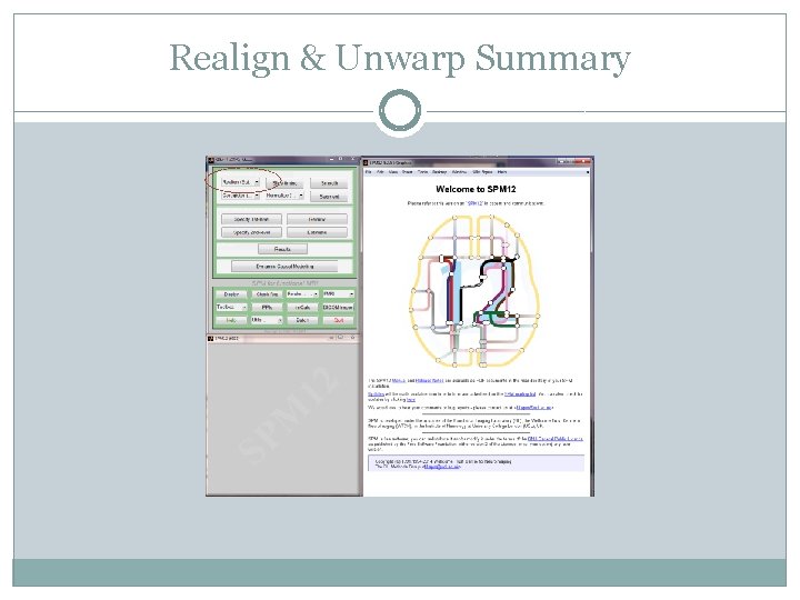 Realign & Unwarp Summary 