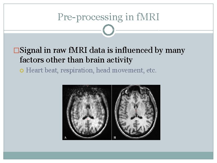 Pre-processing in f. MRI �Signal in raw f. MRI data is influenced by many