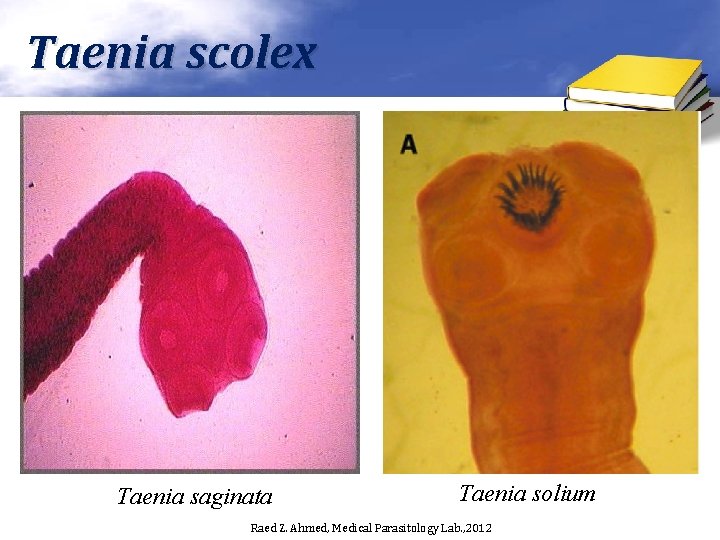 Taenia scolex Taenia saginata Taenia solium Raed Z. Ahmed, Medical Parasitology Lab. , 2012