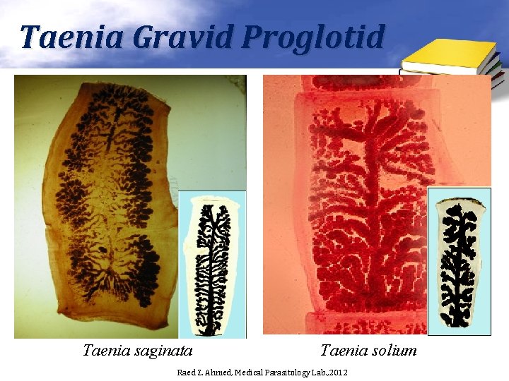 Taenia Gravid Proglotid Taenia saginata Taenia solium Raed Z. Ahmed, Medical Parasitology Lab. ,