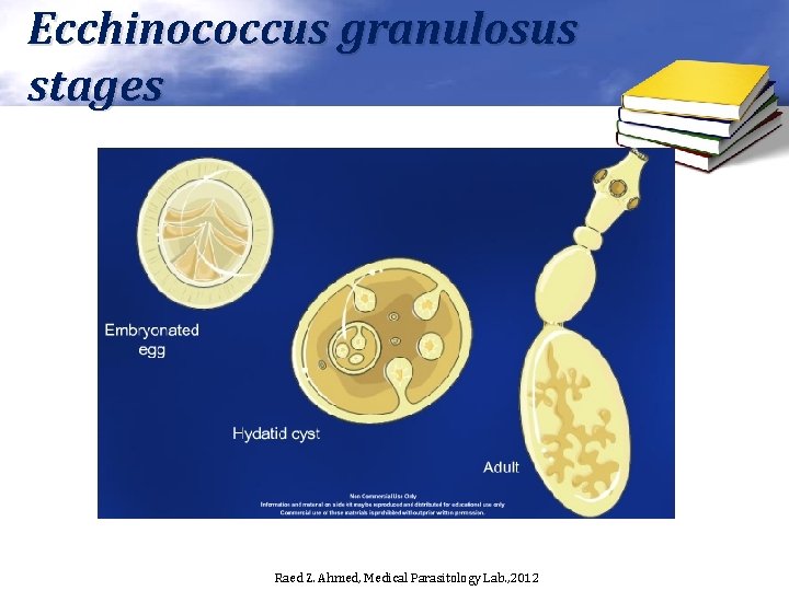 Ecchinococcus granulosus stages Raed Z. Ahmed, Medical Parasitology Lab. , 2012 