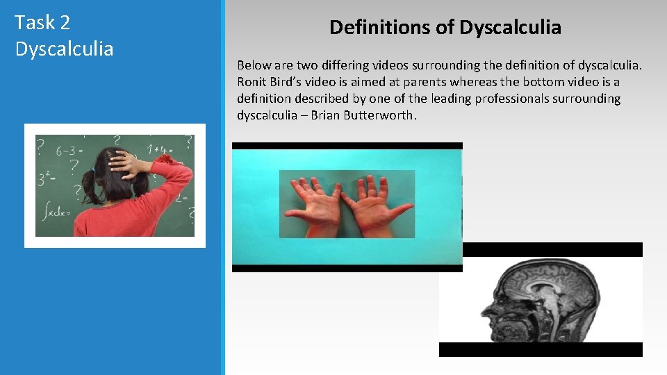 Task 2 Dyscalculia Definitions of Dyscalculia Below are two differing videos surrounding the definition Task 2 Dyscalculia Definitions of Dyscalculia Below are two differing videos surrounding the definition