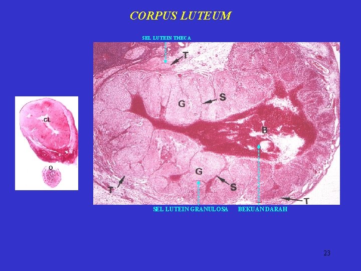 CORPUS LUTEUM SEL LUTEIN THECA SEL LUTEIN GRANULOSA BEKUAN DARAH 23 