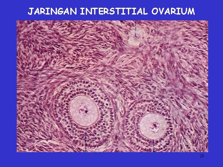 JARINGAN INTERSTITIAL OVARIUM 29 