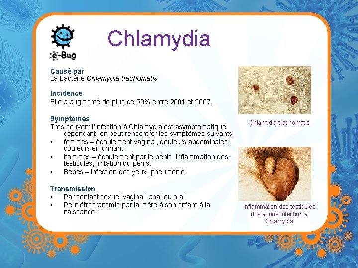 Chlamydia Causé par La bactérie Chlamydia trachomatis. Incidence Elle a augmenté de plus de