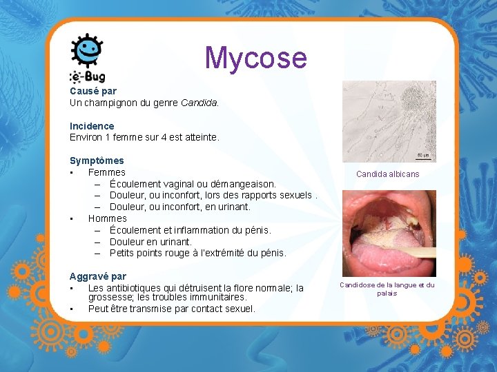 Mycose Causé par Un champignon du genre Candida. Incidence Environ 1 femme sur 4 Mycose Causé par Un champignon du genre Candida. Incidence Environ 1 femme sur 4