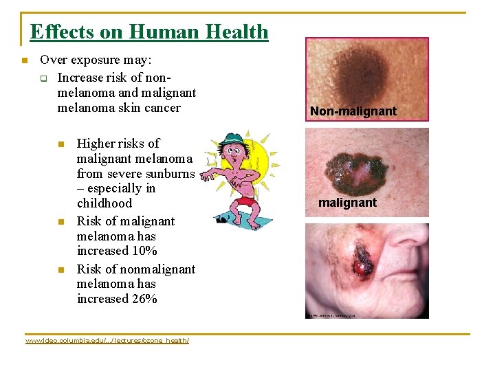Effects on Human Health n Over exposure may: q Increase risk of nonmelanoma and