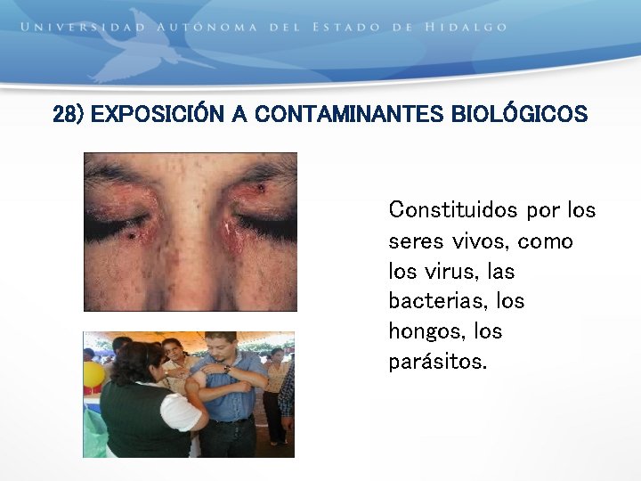 28) EXPOSICIÓN A CONTAMINANTES BIOLÓGICOS Constituidos por los seres vivos, como los virus, las