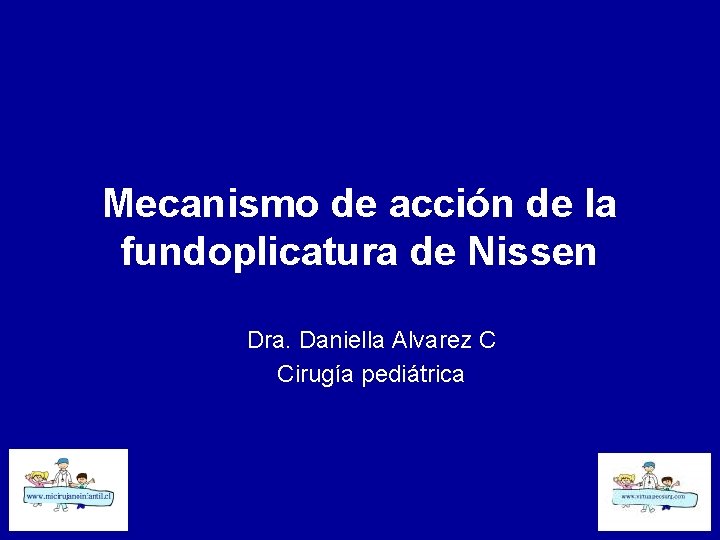 Mecanismo de acción de la fundoplicatura de Nissen Dra. Daniella Alvarez C Cirugía pediátrica