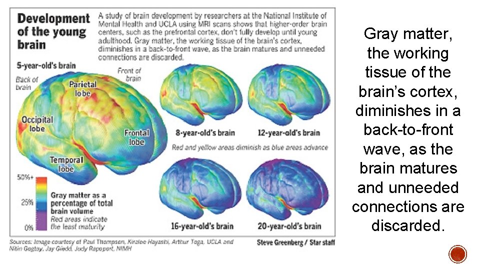 Gray matter, the working tissue of the brain’s cortex, diminishes in a back-to-front wave,