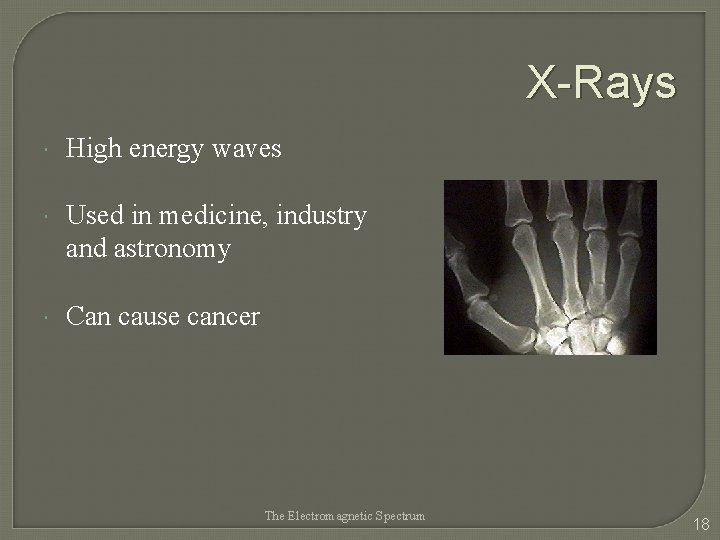 X-Rays High energy waves Used in medicine, industry and astronomy Can cause cancer The