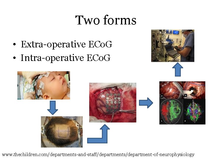 Two forms • Extra-operative ECo. G • Intra-operative ECo. G www. thechildren. com/departments-and-staff/departments/department-of-neurophysiology 