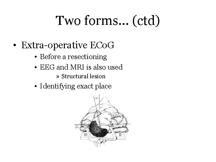 Two forms… (ctd) • Extra-operative ECo. G • Before a resectioning • EEG and