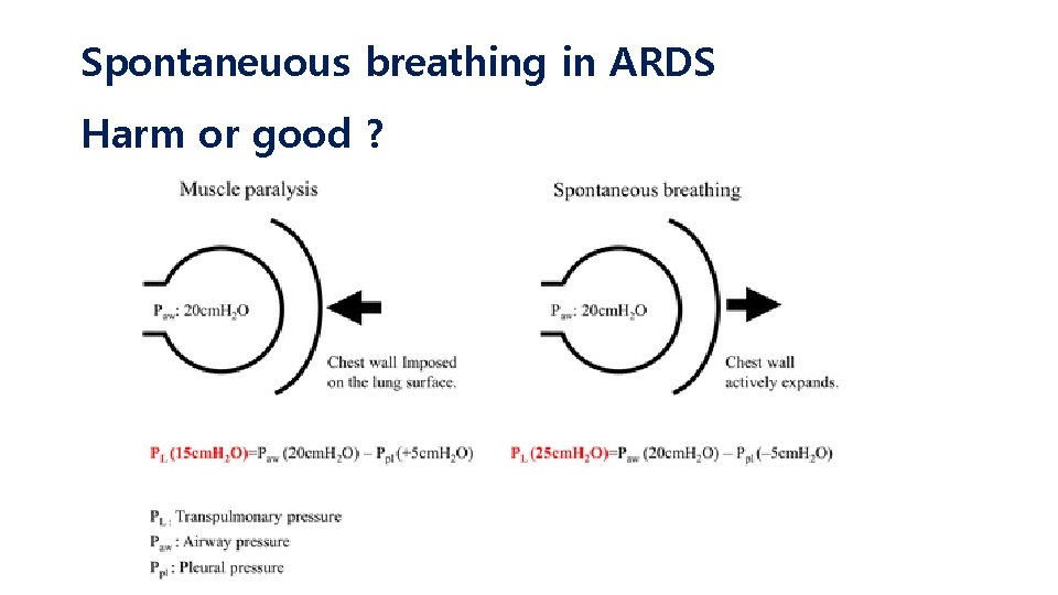 Spontaneuous breathing in ARDS Harm or good ? 