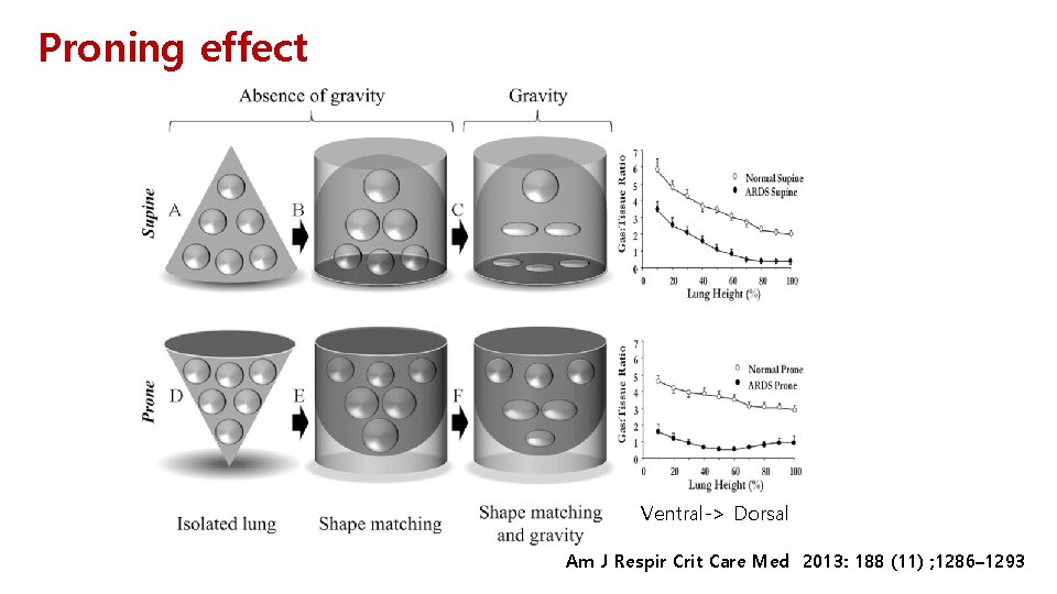 Proning effect Ventral-> Dorsal Am J Respir Crit Care Med 2013: 188 (11) ;