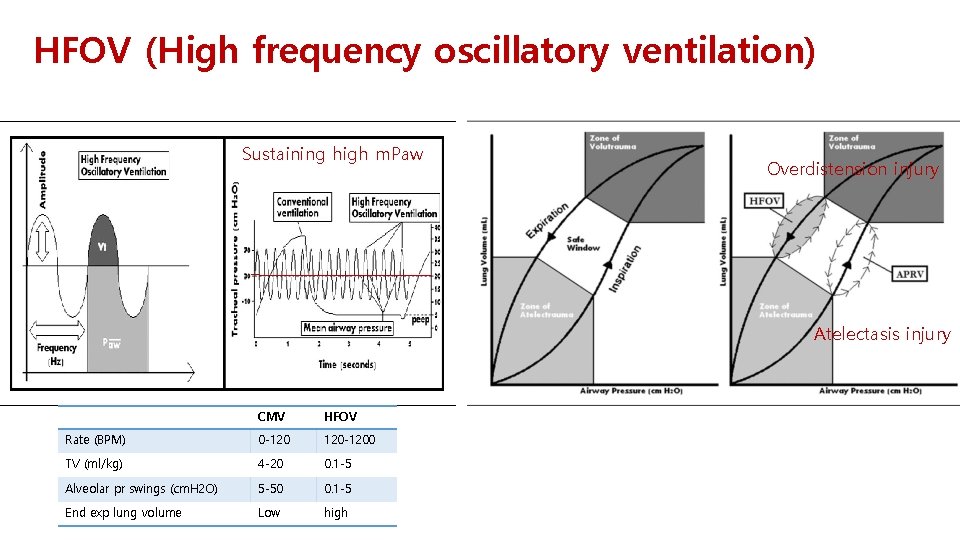 HFOV (High frequency oscillatory ventilation) Sustaining high m. Paw Overdistension injury Atelectasis injury CMV