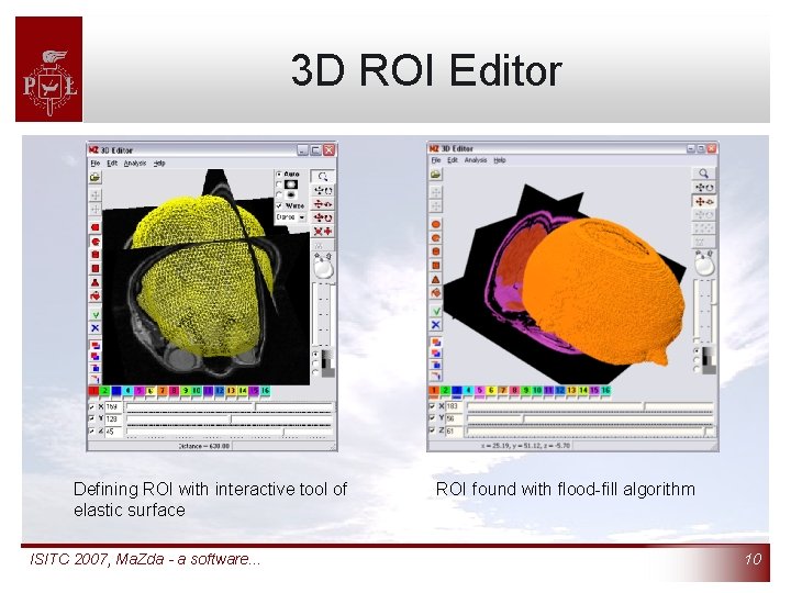 3 D ROI Editor Defining ROI with interactive tool of elastic surface ISITC 2007,