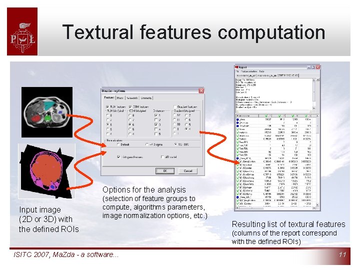 Textural features computation Options for the analysis Input image (2 D or 3 D)