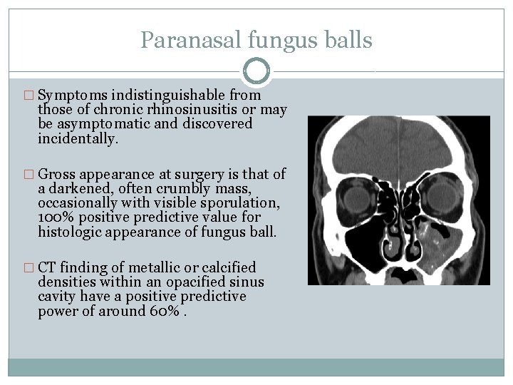 Paranasal fungus balls � Symptoms indistinguishable from those of chronic rhinosinusitis or may be