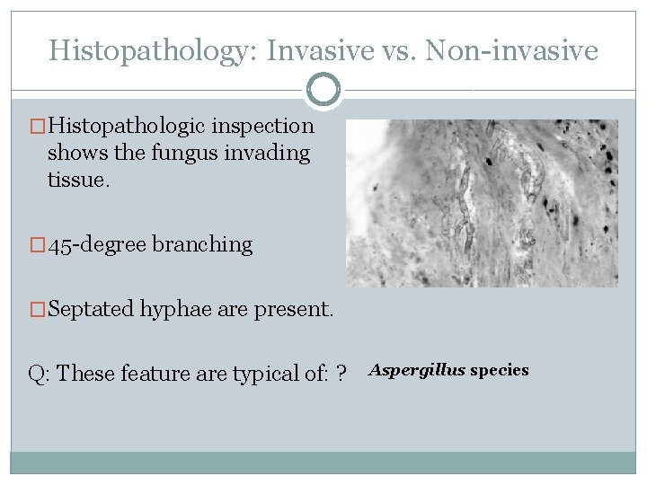 Histopathology: Invasive vs. Non-invasive �Histopathologic inspection shows the fungus invading tissue. � 45 -degree