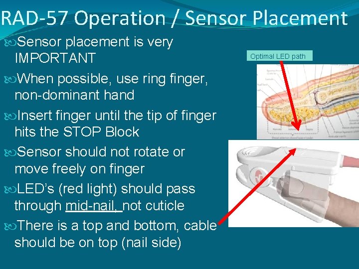 RAD-57 Operation / Sensor Placement Sensor placement is very IMPORTANT When possible, use ring