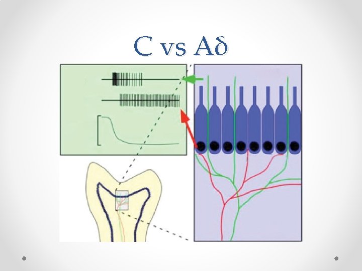 C vs Aδ 