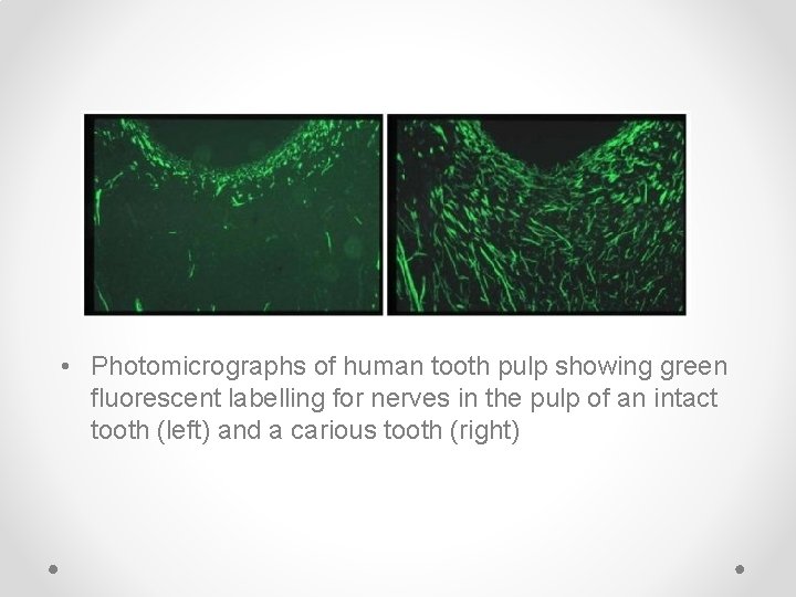  • Photomicrographs of human tooth pulp showing green fluorescent labelling for nerves in