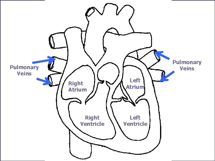 Pulmonary Veins Right Atrium Right Ventricle Left Atrium Left Ventricle 