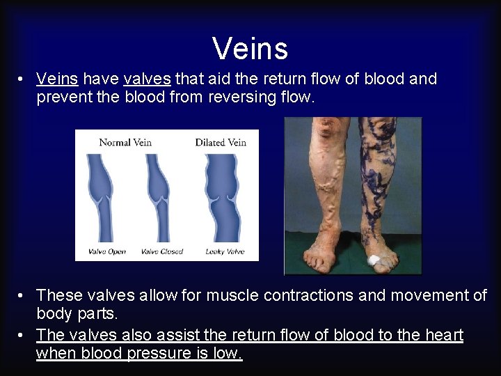 Veins • Veins have valves that aid the return flow of blood and prevent