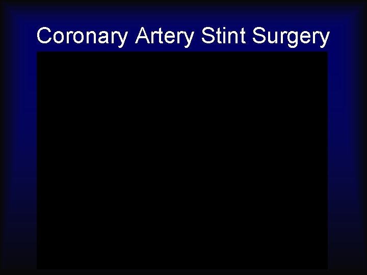 Coronary Artery Stint Surgery 