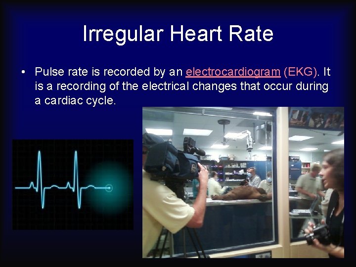 Irregular Heart Rate • Pulse rate is recorded by an electrocardiogram (EKG). It is