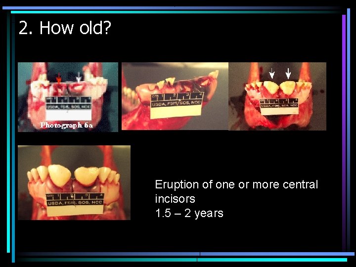 2. How old? Eruption of one or more central incisors 1. 5 – 2