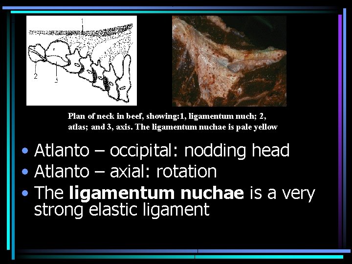 Plan of neck in beef, showing: 1, ligamentum nuch; 2, atlas; and 3, axis.