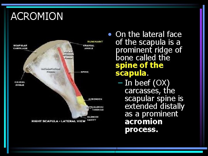 ACROMION • On the lateral face of the scapula is a prominent ridge of