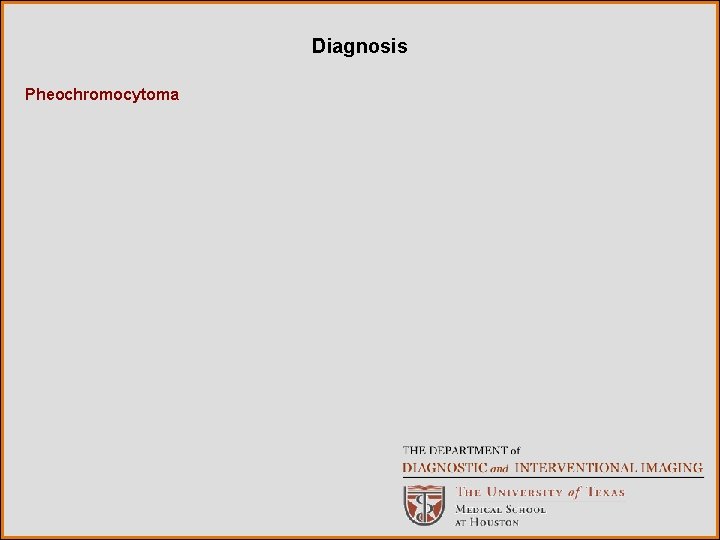 Diagnosis Pheochromocytoma 