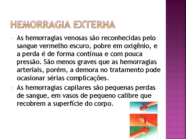  As hemorragias venosas são reconhecidas pelo sangue vermelho escuro, pobre em oxigênio, e